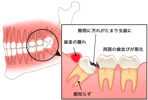 口腔外科 診療内容 一理堂歯科医院 歯科 口腔外科 予防歯科 インプラント 矯正 長野県上田市