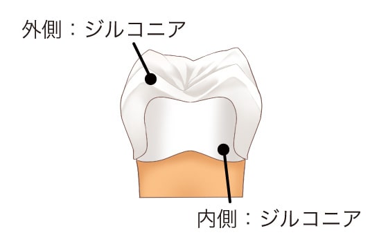 フルジルコニアクラウン